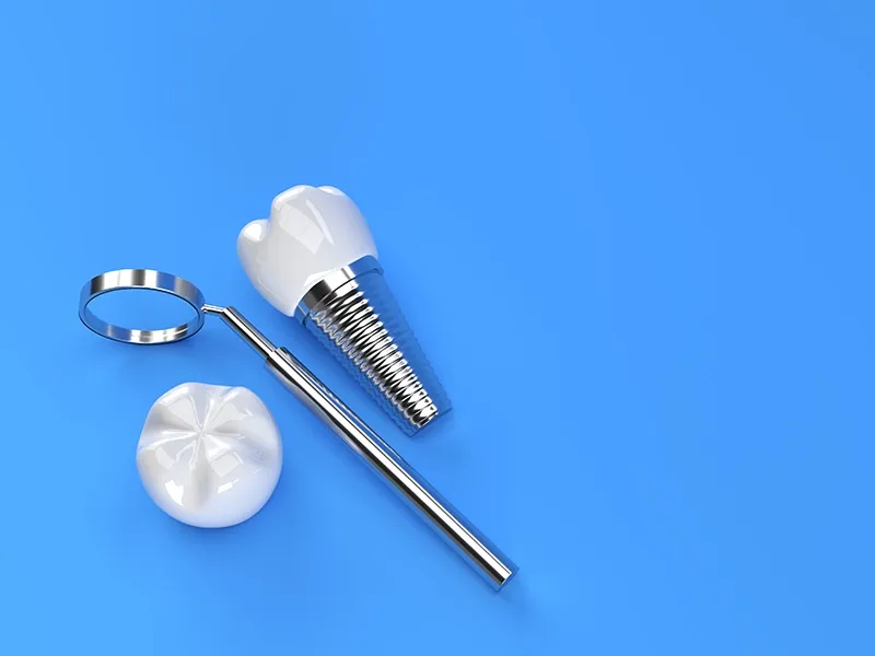 Materials Used in Dental Implants